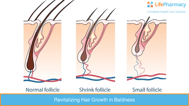 Revitalizing-Hair-Growth-in-Baldness