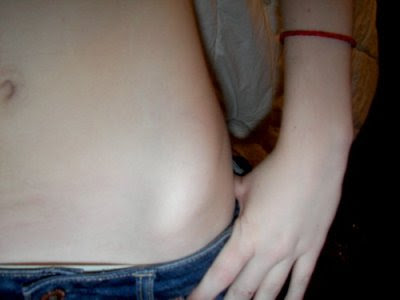 Thinspo