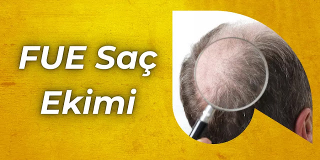 FUE Saç Ekimi