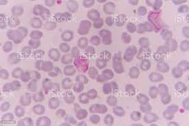 Foto de Plasmodium Vivax