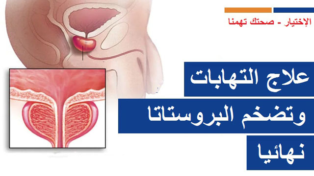 علاج التهابات وتضخم البروستات نهائيا