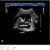 Lady claim she is pregnant for Runtown and share the ultra-scan on IG