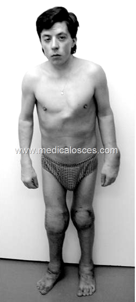 Medical osces