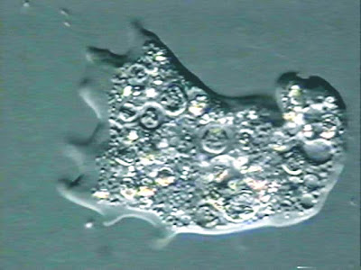 Contoh Gambar Amuba  dan artikel tentang amoeba 