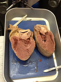 ANATOMY  Pig Heart Dissection 