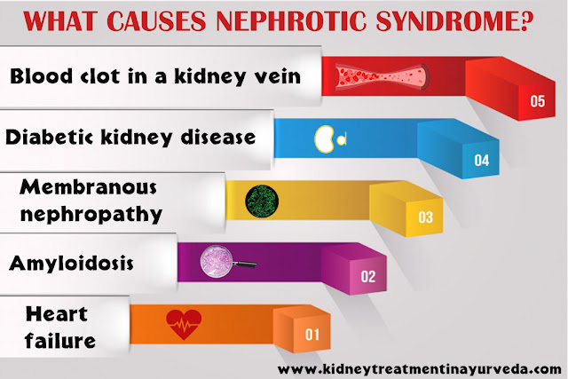 The Hidden Causes of Nephrotic Syndrome