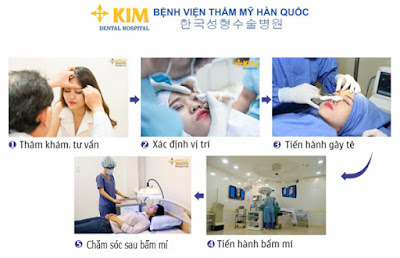 Hình dáng mắt phượng là may mắn của bạn 02