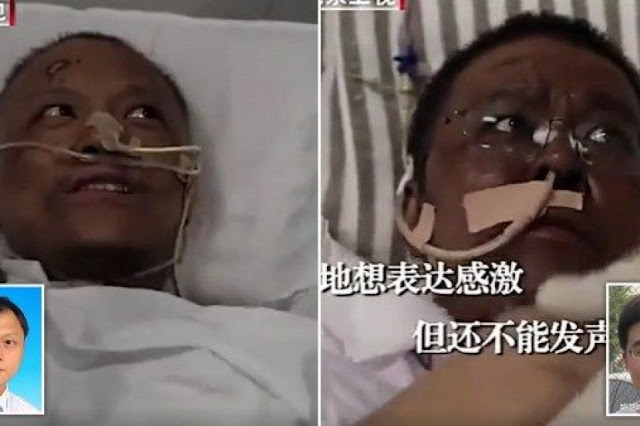 DUA doktor warga China yang tenat akibat Covid-19 mendapati kulit mereka berubah warna selepas pulih daripada jangkitan itu.