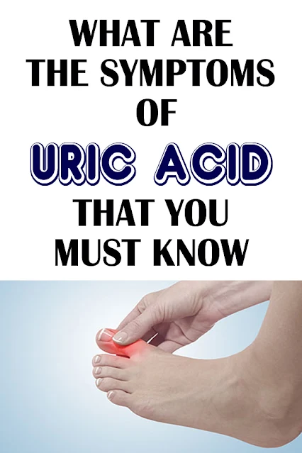What Are The Symptoms Of Uric Acid