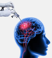 Fissure Specialist Doctor in Jalandhar