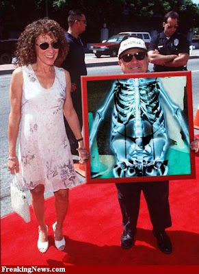 Celebrity xray pics Seen On www.coolpicturegallery.net