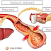 Chế độ dinh dưỡng cho người bị rối loạn chuyển hóa lipid máu