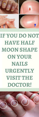 IF YOU DO NOT HAVE HALF MOON SHAPE ON YOUR NAILS, URGENTLY VISIT THE DOCTOR!