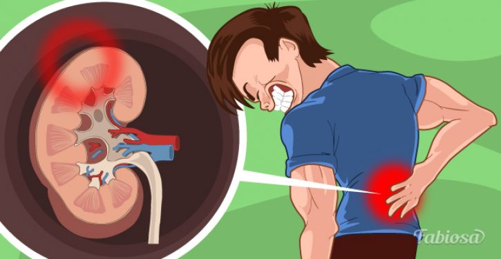 8 Habits That Significantly Damage Your Kidneys