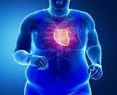 Obesity With Heart Rhythm Disorder