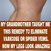 I Am 35 Years Old, My Thighs And Legs Had Varicose Veins, But Thank God This Prescription Eliminated all!