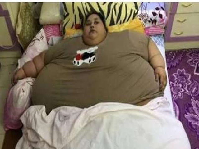 World Fattest Woman Lost 250Kg in 2 Months