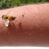 Τσίμπημα από μέλισσα, σφήκα ή άλλα έντομα: Τι κάνουμε σ'αυτές τις περιπτώσεις;