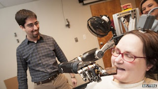 Image of a quadriplegic woman controlling a robotic arm using an Invasive BCI system 