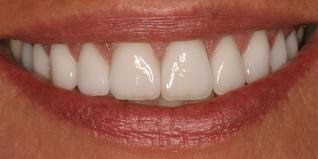 Basking in the Sun and tooth decay have no connection? wrong read this and you will find out
