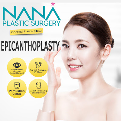 bedah plastik korea, epicanthoplasty, buka sudut mata, operasi di korea, operasi mata, operasi korea, bedah mata, operasi plastik di korea, operasi plastik korea, oplas, oplas korea, lipatan mata korea