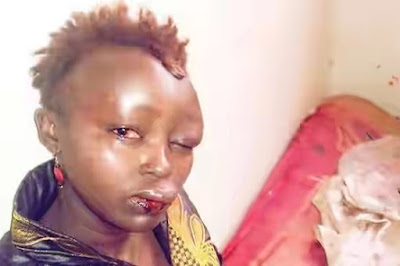 JESUS!! Woman Beaten To Stupor By Crazy Ex-husband (See PICS)