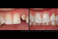 Arlington cosmetic dentistry