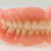 Cấu tạo của hàm răng giả tháo lắp