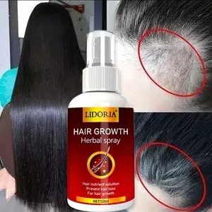 Ginger Hair Growth Spray Serum For Anti Hair Loss Essential Oil Products Fast Treatment Prevent Hair Thinning Dry Frizzy Repair US $4 2 sold Free Shipping
