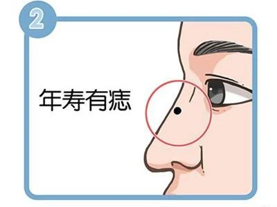 관상