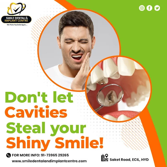 Teeth Cleaning
