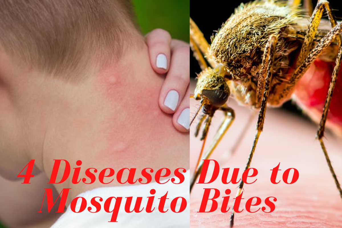 4 Diseases Due to Mosquito Bites