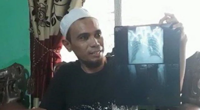 Tegur Remaja Main Petasan, Ustaz Qomar Dikeroyok Sampai Retak Tulang Rusuk