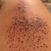 Chai: See what happened to a woman's thighs after her phone case cracked and the liquid touched her skin [Photos]
