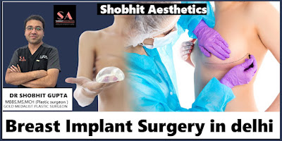 Brеast Implants in India