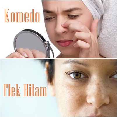 Cream Penghilang Komedo Dan Flek Hitam