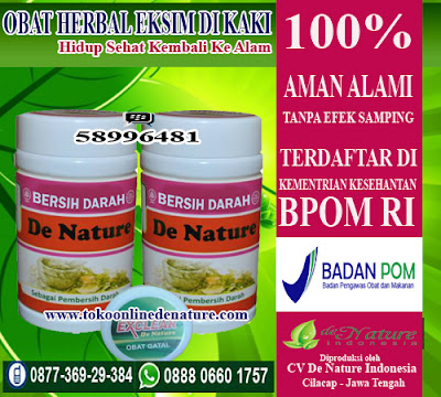 OBAT HERBAL EKSIM DI KAKI