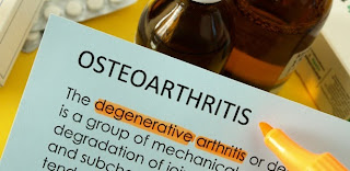 Osteoporosis