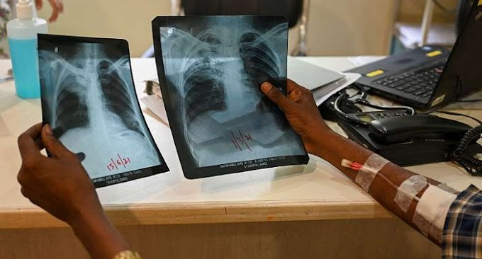  Tanzanian TB patients have a lower personal satisfaction than individuals who haven't had the illness
