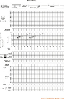 adalah alat bantu untuk memantau kemajuan kala suatu persalinan dan info untuk membua Apa itu Partograf ?