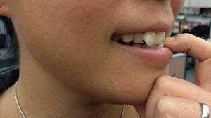 http://crackednail-polish.blogspot.com/2013/07/homeopathic-toenail-fungus-treatment.html