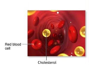 cholesterol