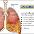 Mesothelioma lawyer FIRE SAFETY AND HEALTH