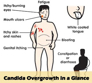 Candida Die Off Symptoms