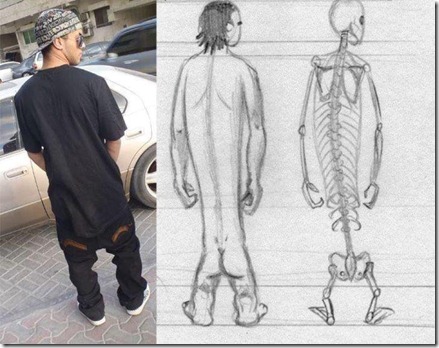 low hip