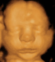 3d Ultrasound 29 Weeks