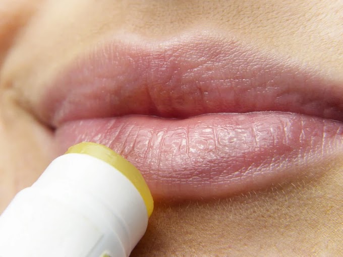 Cómo actuar ante el herpes labial