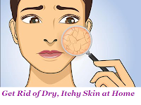 Get Rid of Dry, Itchy Skin at Home