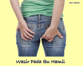 wasir pada ibu hamil