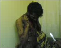 23wounding1_L